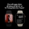 Ảnh của Apple Watch Series 12 46mm (GPS + Cellular) Milanese Loop size S/M
